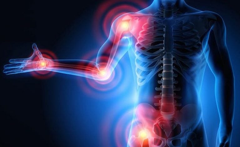 Anti Inflammatation