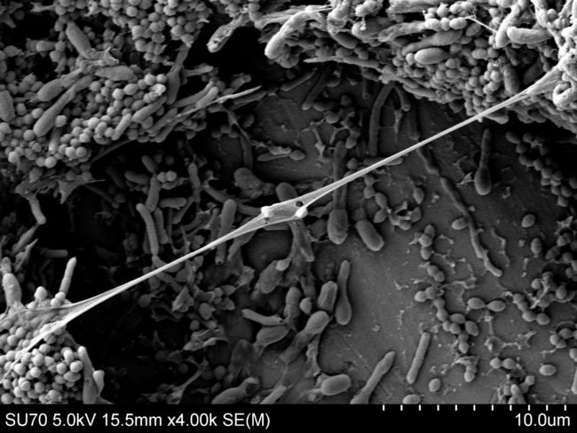 Anti-bacterial Mixed Culture Biofilm