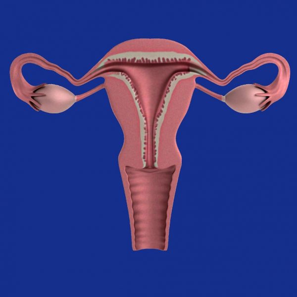 Polycystic Ovarian Syndrome