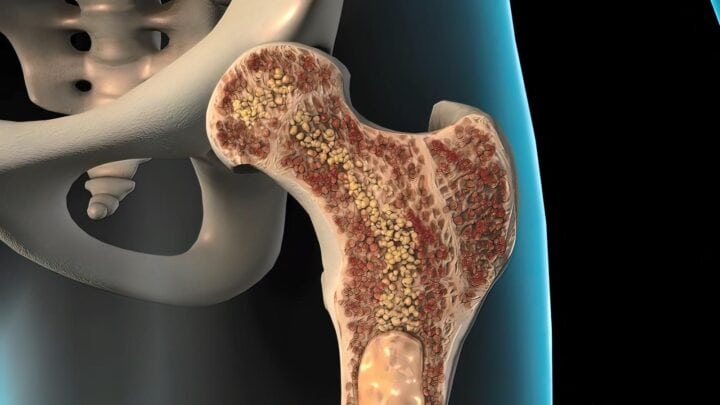 Internal Structure Of The Bone Of A Person With Leg, Foot Pain And Rheumatic Disease